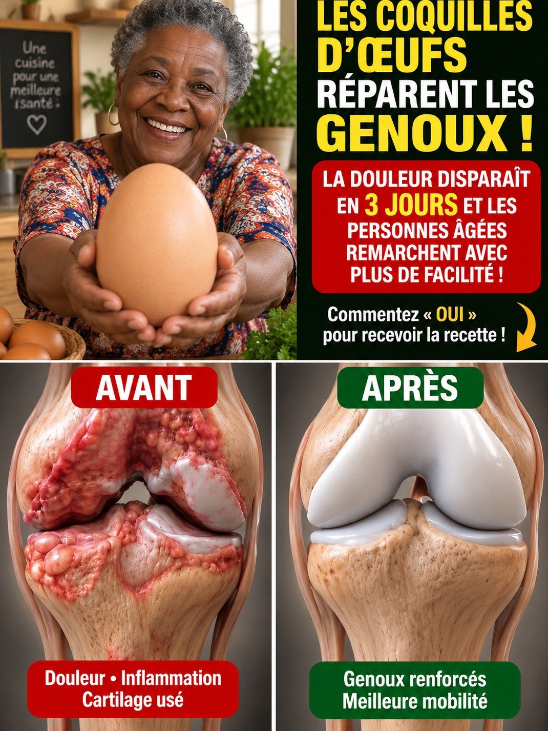 Vos Genoux vous Font Souffrir ? Ne Jetez PLUS vos Coquilles d'Œufs avant de Lire CECI (La Vérité Révélée)
