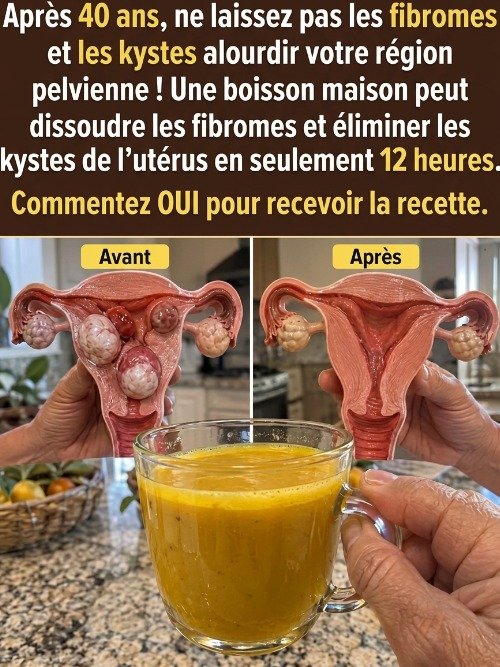 Le Secret Inattendu après 40 Ans : Cette Boisson Au Gingembre Et Curcuma Va Révolutionner Votre Confort Face Aux Fibromes Et Kystes !