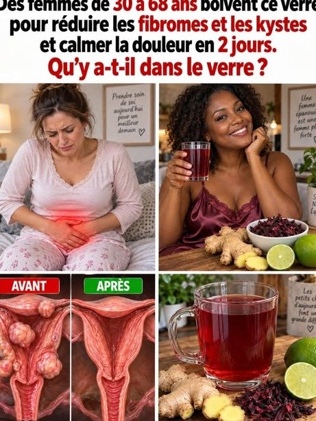 Fibromes & Kystes : L'Erreur FATALE que vous faites avec cette boisson virale (et ce qui marche VRAIMENT) !