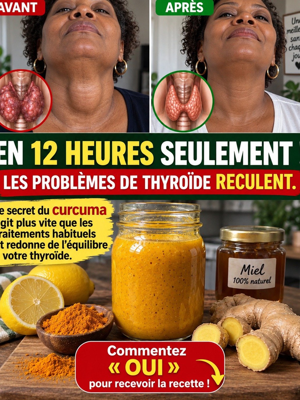 La Vérité Choc sur le Curcuma et Votre Thyroïde : Ne Tombez Pas dans le Piège des Solutions Miracles !