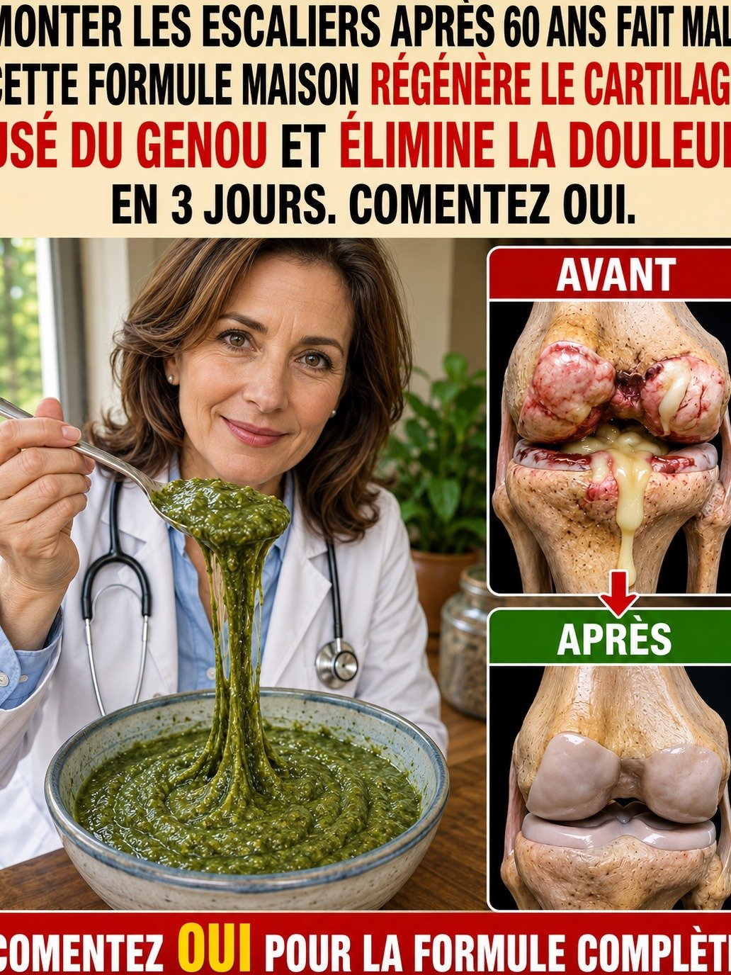 Genoux Usés : Le Rituel Simple en 3 Étapes pour Dire Adieu aux Douleurs dans les Escaliers (Ne Manquez Pas la Petite Étape Clé !)
