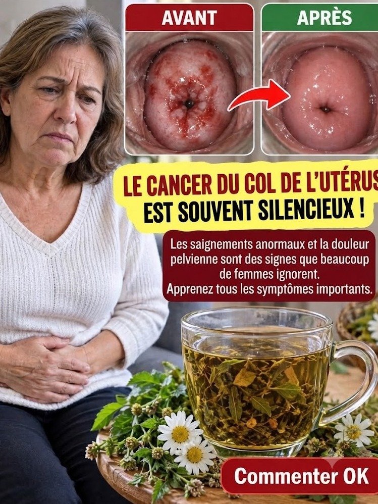 ALERTE ROUGE : Le Cancer du Col de l'Utérus S'insinue en Silence ! Ces 7 Signes Que VOUS Devez ABSOLUMENT Connaître Avant Qu'il Ne Soit Trop Tard