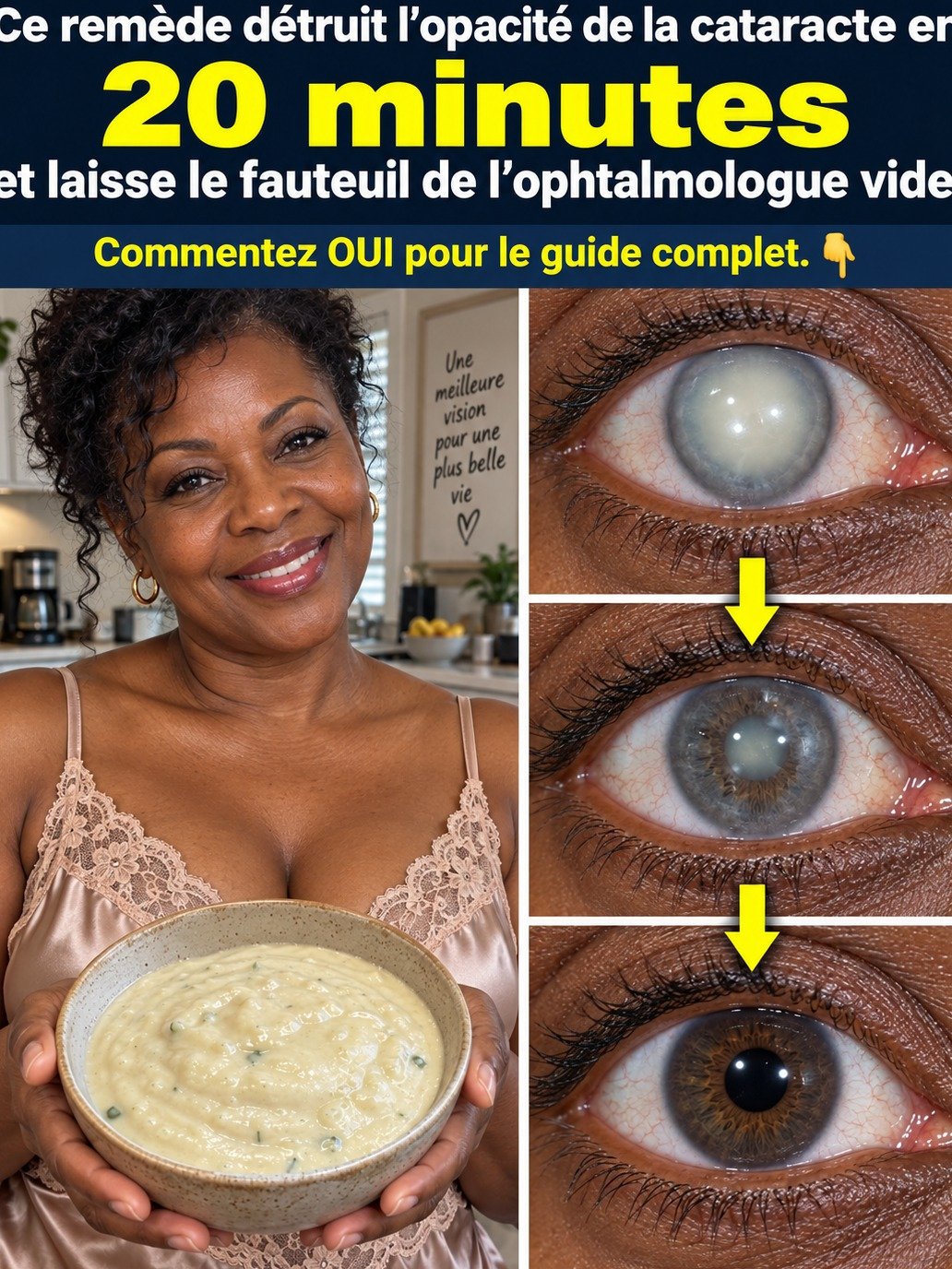 Cataracte : Le Secret Naturel Qui Dissipe le Voile et Rétablit une Vision Nette ! (Ne Lisez Pas Si Vous Aimez le Flou)