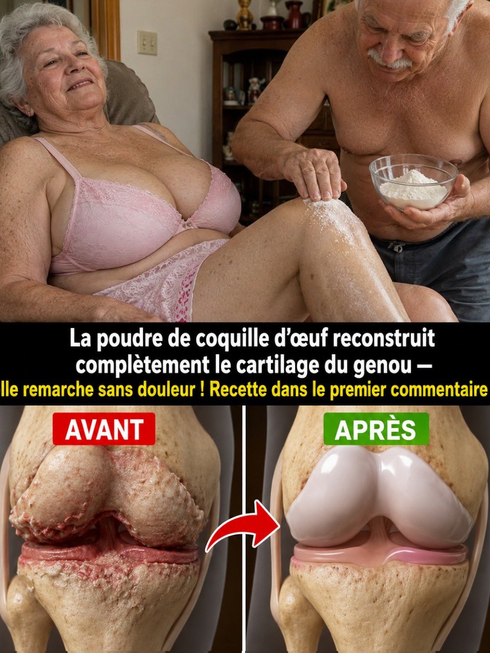 Arrêtez TOUT ! Ce Secret à 0€ Pourrait "Réinitialiser" le Cartilage de Vos Genoux et Mettre Fin à la Douleur Chronique