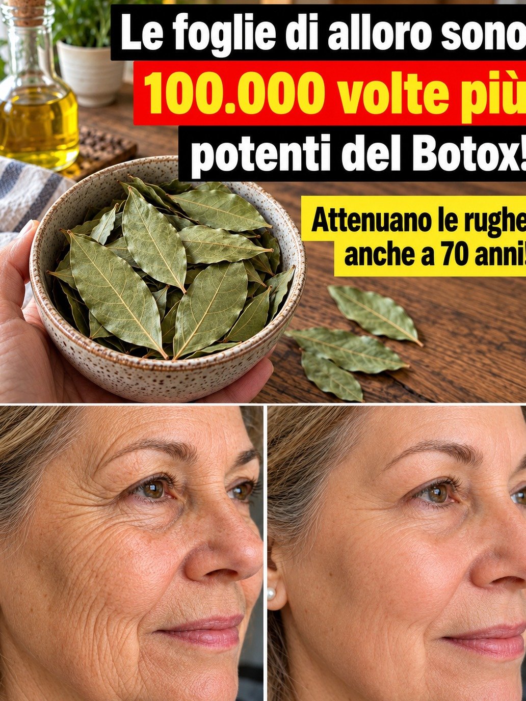 Rides, Teint Terne : Révélation Choc sur le Laurier, le 'Botox Naturel' qui Transforme Votre Peau !