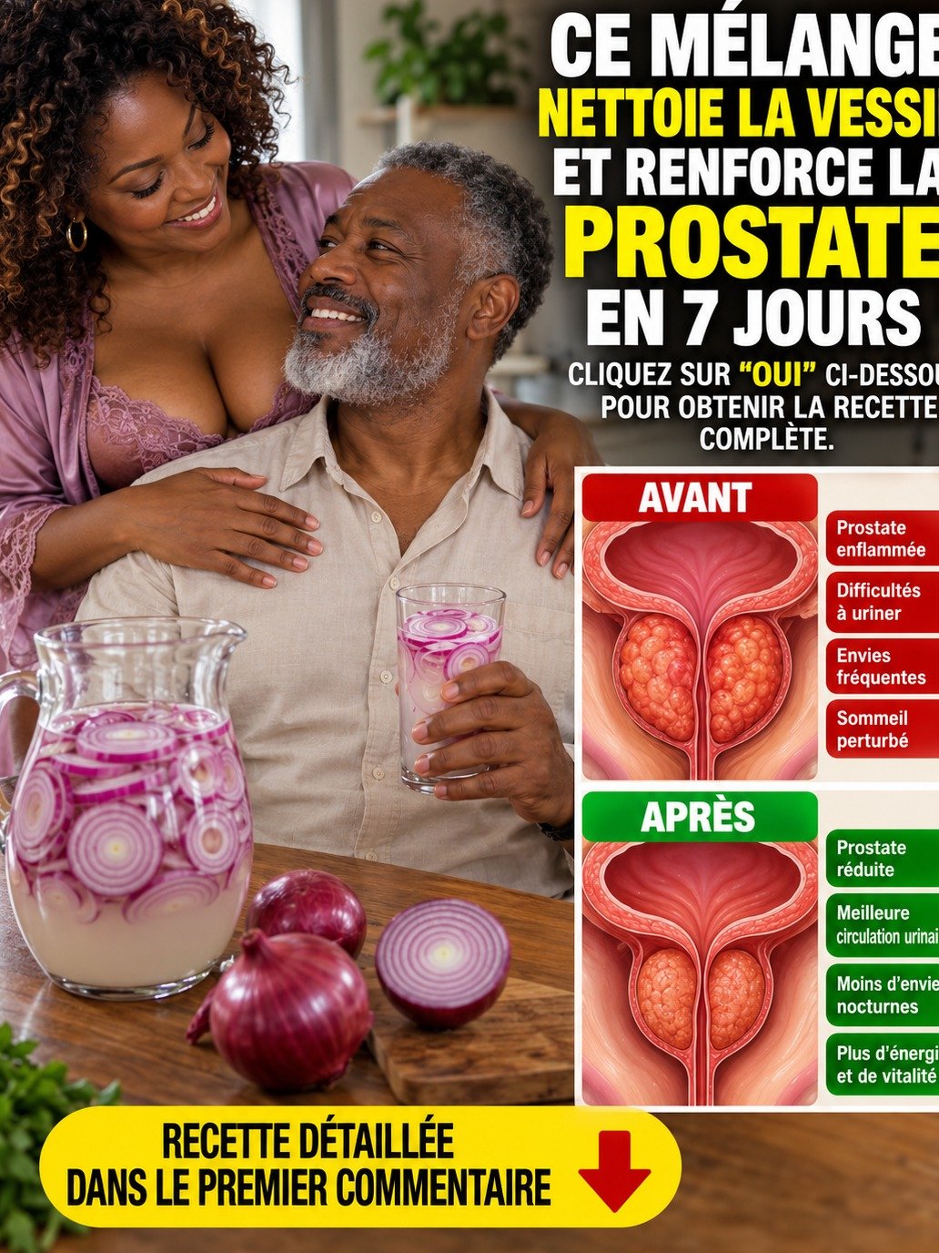 Vessie sous Pression, Prostate Gonflée ? Le SECRET de l'Oignon Rouge va TOUT changer (Vous devez lire ça !)