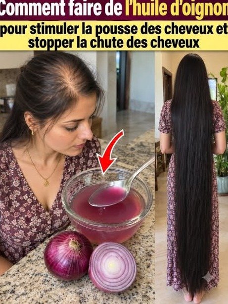 Le Secret Viral de l'Oignon: Réveillez Vos Follicules Endormis et Transformez Vos Cheveux (Ce Que L'Industrie Cache)