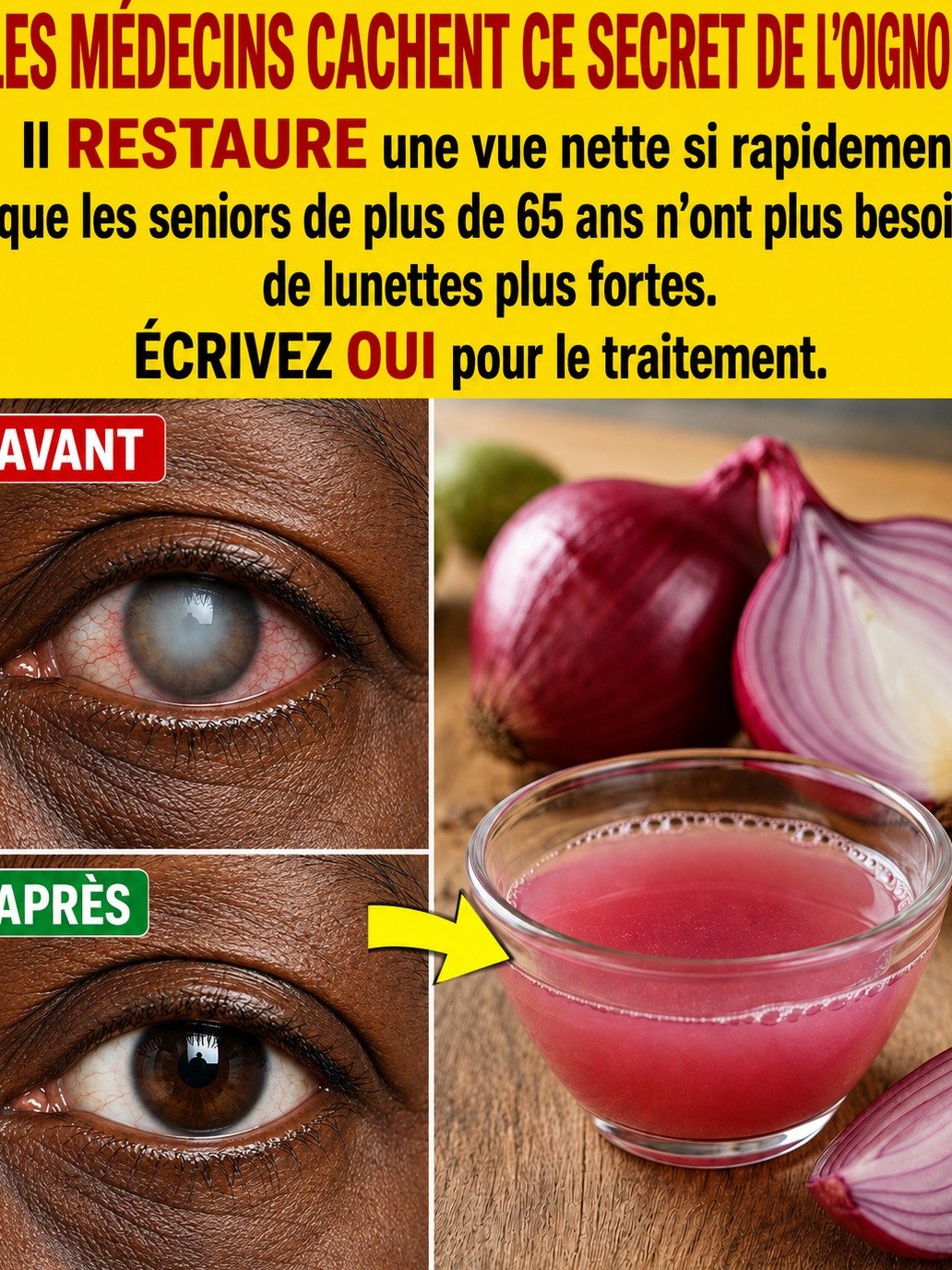 Le Secret BIOLOGIQUE de l'Oignon Rouge que les Médecins Cachent pour une Vision Nette et Sans Efforts (Même après 65 ans) !