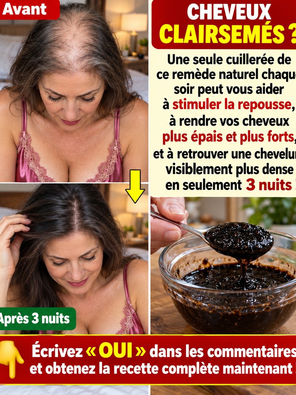 Le Rituel Secret du Soir : Une Cuillère de Gingembre Peut-elle Vraiment Transformer Vos Cheveux?