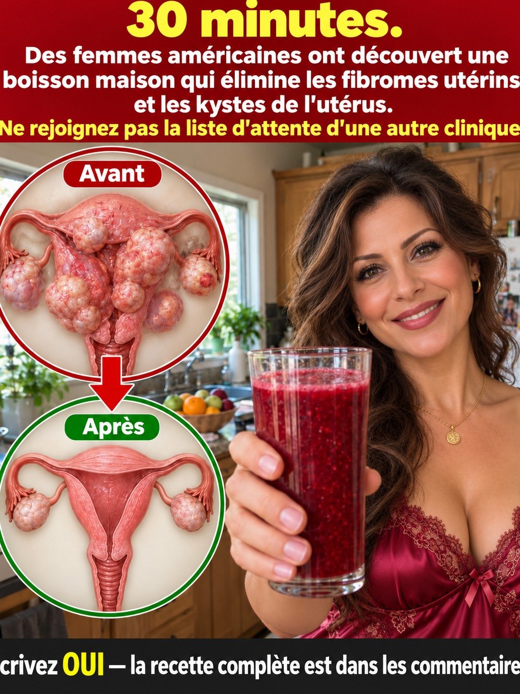 Fibromes Utérins : L'erreur INSOUPÇONNÉE que vous faites avec cette boisson quotidienne et qui les fait grossir !