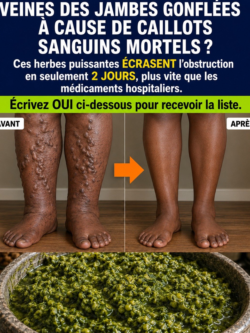 Jambes Lourdes et Gonflées ? Le Secret de 3 Herbes de Cuisine Pour des Veines Réveillées et un Soulagement Radical DÈS CE SOIR !