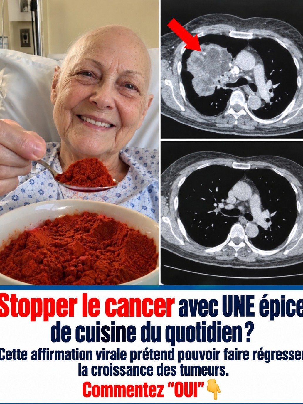 Le Secret Choc d'une Épice Quotidienne : Elle Pourrait Freiner la Croissance des Tumeurs et Révolutionner Votre Santé !