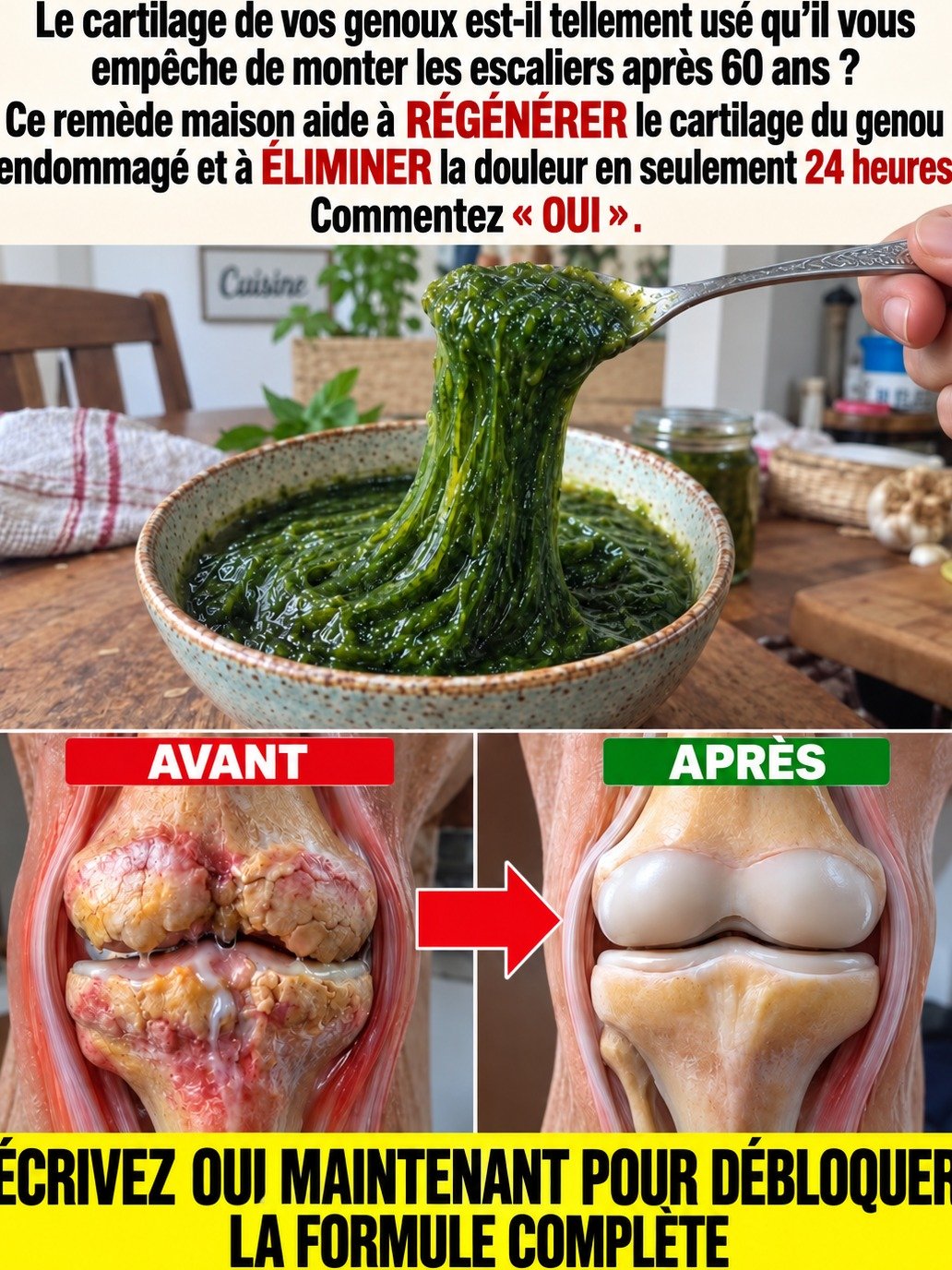 Genoux Douloureux Après 60 Ans ? Si les Escaliers Sont un Cauchemar, NE CROYEZ PAS ce Remède Viral : La Vraie Solution est ICI !