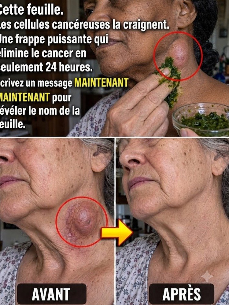 Le Secret Dévoilé : Cette feuille que les cellules cancéreuses 'craindraient' le plus – La VÉRITÉ choquante sur ce qu'elle fait dans votre corps !