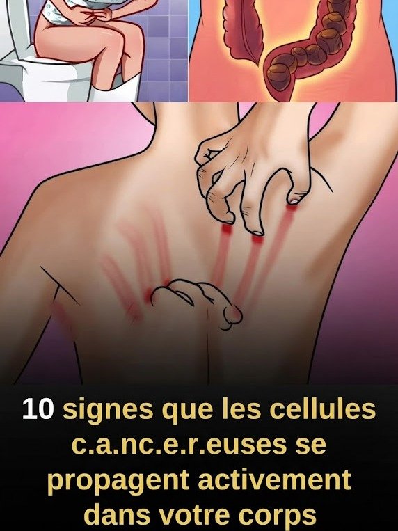 10 Signes Cruciaux que Votre Corps Vous Envoie : Ce Que Vous DEVEZ Savoir sur le Cancer Avant Qu'il Ne Soit Trop Tard !