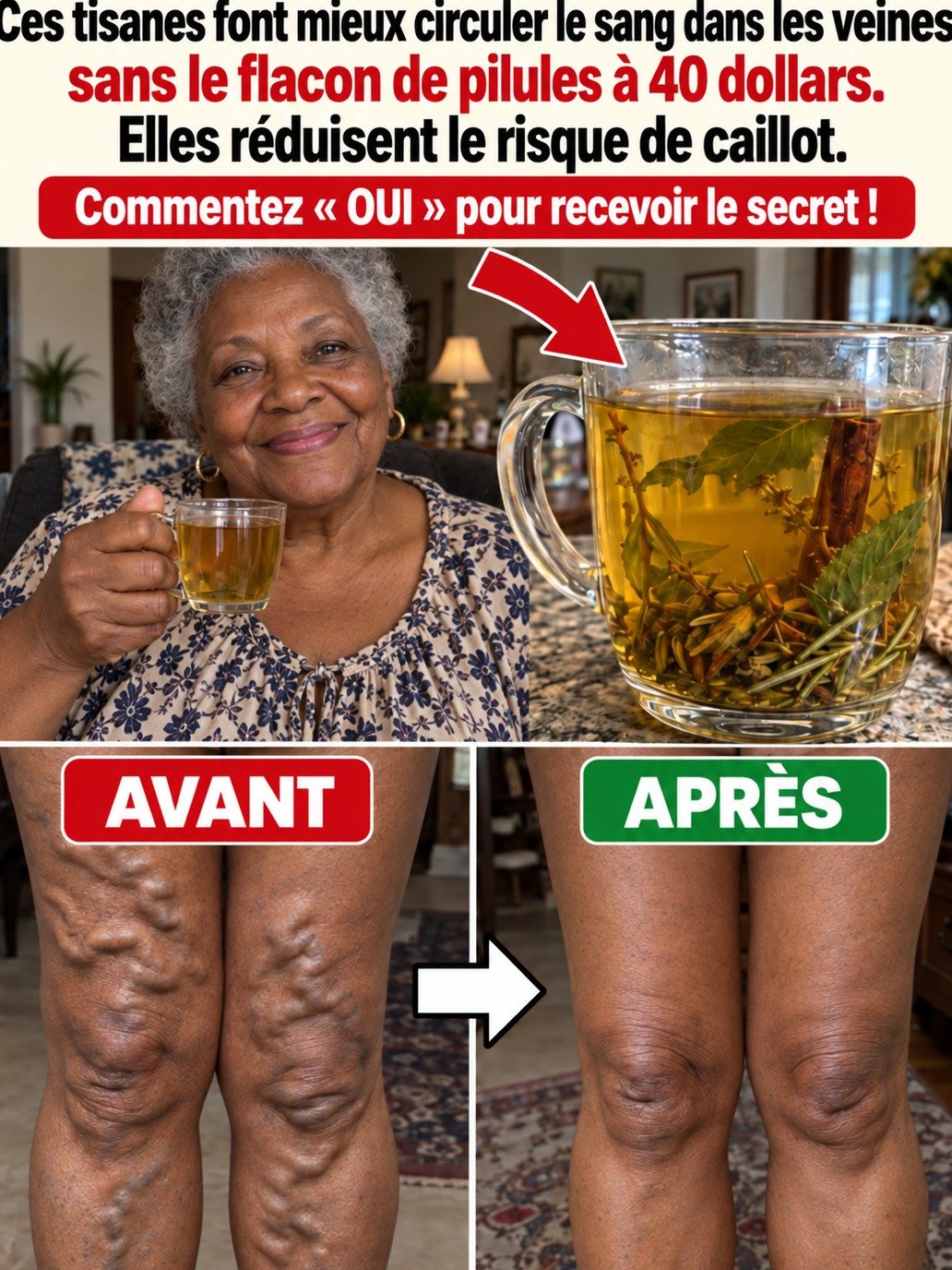 Révélation Choc : Votre Tisane Préférée Peut-elle VRAIMENT Combattre les Varices et les Caillots Sanguins ? La Vérité Qui Va Vous Surprendre !