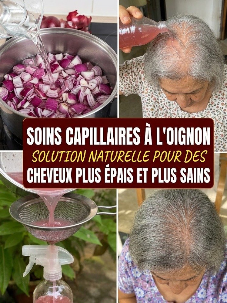 STOP à la Chute de Cheveux ! Ce Secret Naturel à l'Oignon Rouge Va Combler Vos Zones Clairsemées et Sauver Votre Crinière !