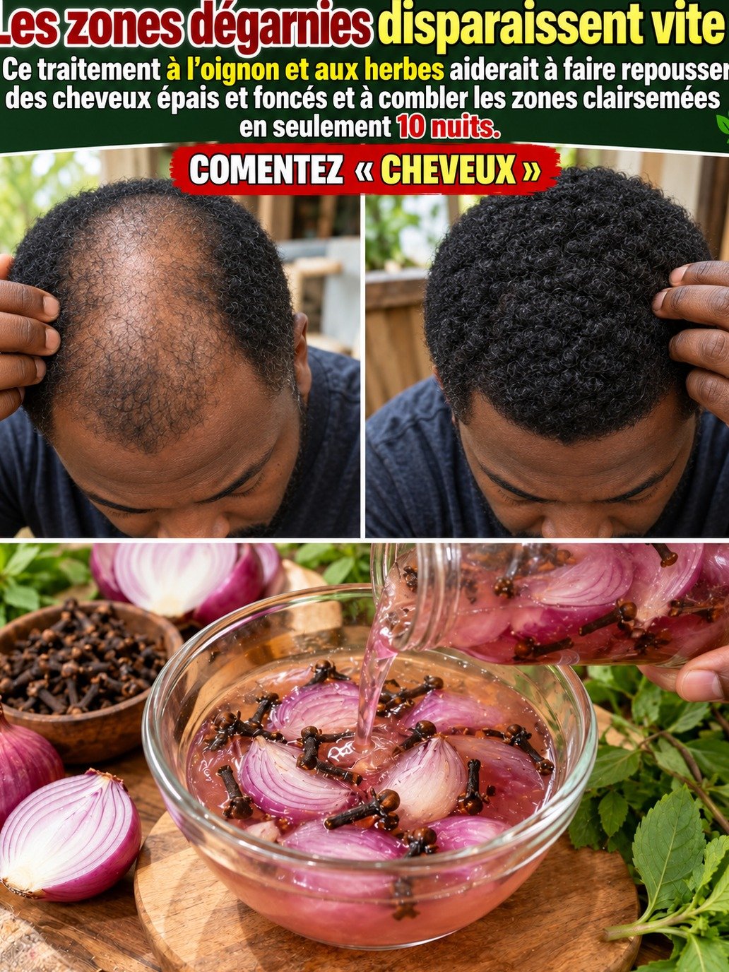 Le Secret Oublié pour des Cheveux Plus Denses ? Oignon & Clou de Girofle : Le Duo Choc Qui Fait le Buzz !