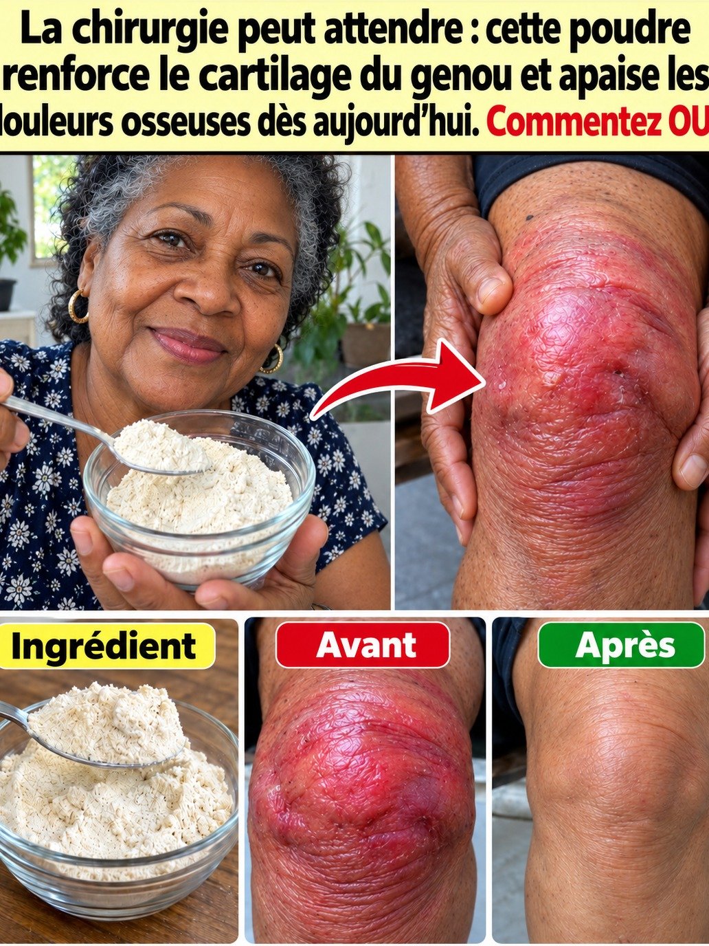Le Secret d'une Poudre Mystérieuse pour Vos Genoux Douloureux ? Découvrez ENFIN ce Qui Soulage VRAIMENT l'Inflammation et Protège Votre Cartilage !