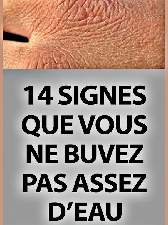 Le Signal d'Alarme de Votre Corps : 14 Signes Étonnants Que Vous Ne Buvez PAS Assez d'Eau (Ne les Ignorez Plus !)
