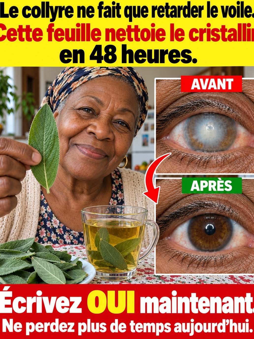 Cataracte : Attention ! Cette